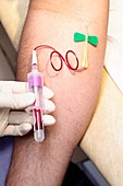 Blood sampling,tuberculosis test