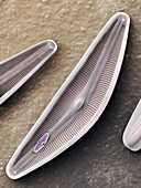 Diatom frustules (SEM)