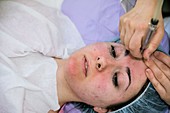 Microdermabrasion beauty treatment