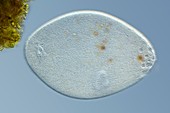 Ciliate protozoan,light micrograph