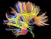 White matter fibres of the human brain