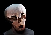 Neanderthal child's skull