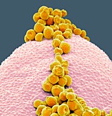 Fungal spores on pollen grain,SEM