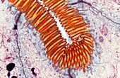 Intestinal brush border,TEM