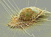 Mouth cancer cell,SEM