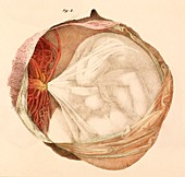 Five-month-old foetus,1825 artwork