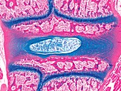 Foetal spine development light micrograph