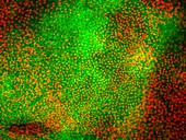 Stem cell-derived retinal cells