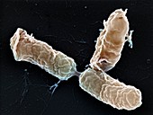 Bordetella pertussis bacteria,SEM