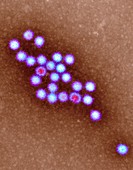 Norovirus particles,TEM