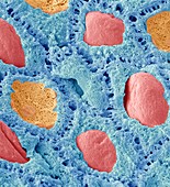 Keratinocyte skin cells,SEM