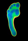 Foot,thermogram