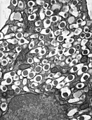 Islet of Langerhans beta cell,TEM