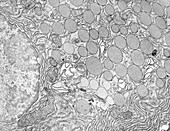 Pancreatic acinar cell