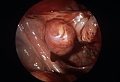 Corpus luteum in ovarian cycle