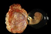 Human foetus,8 weeks old