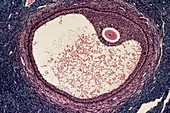 Ovarian follicle,light micrograph