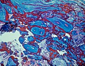 Placenta,light micrograph