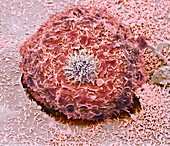 Colorectal cancer cell,SEM