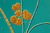 Microalgae,light micrograph