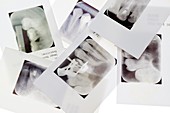 Dental X-rays