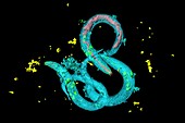 C. elegans worms,light micrograph