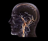 Vascular system of the head,MRI scan