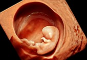 10 week foetus,3-D ultrasound scan