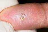 Finger wound from a splinter