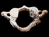 Homo heidelbergensis vertebra
