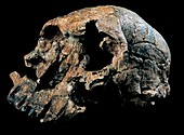 Homo rudolfensis skull (KNM-ER 1470)