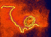 Measles virus particle,TEM
