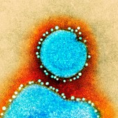 Avian influenza virus,TEM