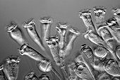 Vorticella protozoa,light micrograph