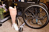 Prosthetic limb and wheelchair