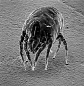 House dust mite,SEM