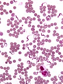 Trypanosomes in blood smear,SEM