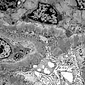 Intraglomerular mesangial cells,TEM