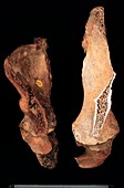 Homo sp. pelvis comparison