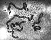 Chromosomes,light micrograph