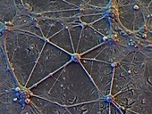 Brain nerve cells,SEM