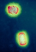 Monkeypox virus particles,TEM