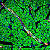 Heart muscle,fluorescence micrograph