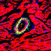 Heart muscle,fluorescence micrograph