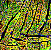 Heart muscle,fluorescence micrograph