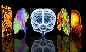 Neurology slide show