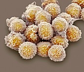 Lymphocyte white blood cells,SEM