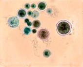 Hartmannella vermiformis protozoa cysts