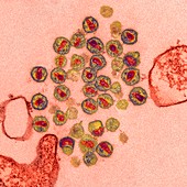 HIV virus particles,TEM