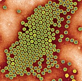 Polio virus particles,TEM